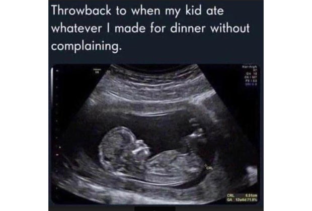 untrasound meme