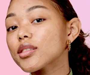 Zitsticka Best Teen Skincare and Pimple Patches Kids Are Obsessed With